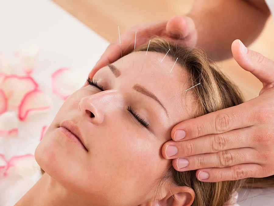 Kopfmassage und Akupunktur